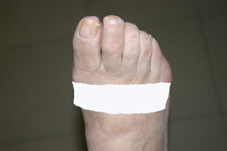 Imatge real post operat�ria